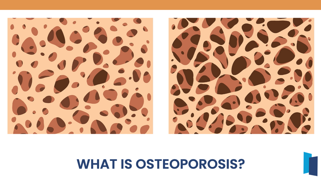 Osteoporosis
